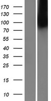 MBTPS2 Protein - Western validation with an anti-DDK antibody * L: Control HEK293 lysate R: Over-expression lysate