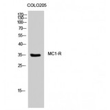 MC1R Antibody - Western blot of MC1-R antibody