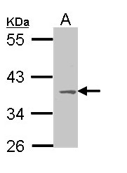 MC1R Antibody - Sample (30 ug of whole cell lysate). A: Molt-4 . 10% SDS PAGE. MC1R antibody diluted at 1:1000.