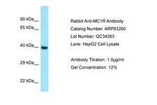 MC1R Antibody -  This image was taken for the unconjugated form of this product. Other forms have not been tested.