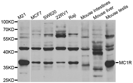 MC1R Antibody - Western blot analysis of extracts of mouse intestine tissue lysate, using MC1R antibody.