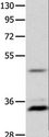 MC1R Antibody - Western blot analysis of Mouse intestinum tenue tissue, using MC1R Polyclonal Antibody at dilution of 1:1450.