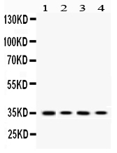 MC1R Antibody - Western blot - Anti-MC1 Receptor Picoband Antibody