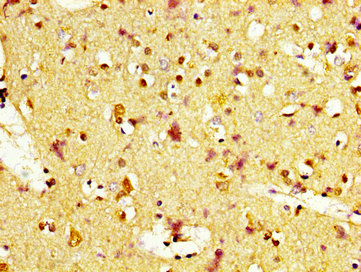 MC1R Antibody - Immunohistochemistry image at a dilution of 1:400 and staining in paraffin-embedded human brain tissue performed on a Leica BondTM system. After dewaxing and hydration, antigen retrieval was mediated by high pressure in a citrate buffer (pH 6.0) . Section was blocked with 10% normal goat serum 30min at RT. Then primary antibody (1% BSA) was incubated at 4 °C overnight. The primary is detected by a biotinylated secondary antibody and visualized using an HRP conjugated SP system.
