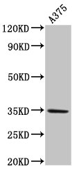 MC1R Antibody - Positive Western Blot detected in A375 whole cell lysate. All lanes: MC1R antibody at 4 µg/ml Secondary Goat polyclonal to rabbit IgG at 1/50000 dilution. Predicted band size: 35 KDa. Observed band size: 35 KDa
