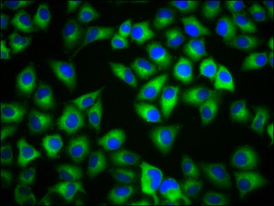 MC1R Antibody - Immunofluorescence staining of Hela cells with MC1R Antibody at 1:133, counter-stained with DAPI. The cells were fixed in 4% formaldehyde, permeabilized using 0.2% Triton X-100 and blocked in 10% normal Goat Serum. The cells were then incubated with the antibody overnight at 4°C. The secondary antibody was Alexa Fluor 488-congugated AffiniPure Goat Anti-Rabbit IgG(H+L).
