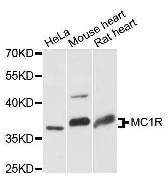 MC1R Antibody - Western blot analysis of extracts of various cell lines, using MC1R antibody at 1:3000 dilution. The secondary antibody used was an HRP Goat Anti-Rabbit IgG (H+L) at 1:10000 dilution. Lysates were loaded 25ug per lane and 3% nonfat dry milk in TBST was used for blocking. An ECL Kit was used for detection and the exposure time was 5s.