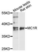 MC1R Antibody - Western blot analysis of extracts of various cell lines, using MC1R antibody at 1:1000 dilution. The secondary antibody used was an HRP Goat Anti-Rabbit IgG (H+L) at 1:10000 dilution. Lysates were loaded 25ug per lane and 3% nonfat dry milk in TBST was used for blocking. An ECL Kit was used for detection and the exposure time was 15s.