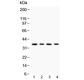 MC1R Antibody - Western blot testing of 1) rat PC12, 2) mouse Hepa1-6, 3) human HeLa and 4) human A375 cell lysate with MC1R antibody at 0.5ug/ml. Predicted molecular weight ~35 kDa.