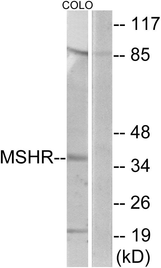 MC1R Antibody - Western blot analysis of extracts from COLO205 cells, using MSHR antibody.