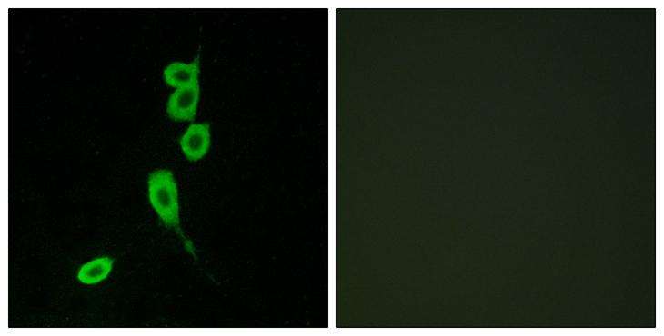 MC1R Antibody - Peptide - + Immunofluorescence analysis of LOVO cells, using MSHR antibody.