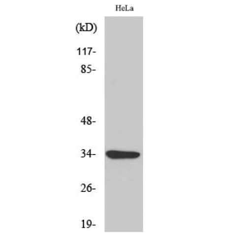 MC2R / ACTHR / ACTH Receptor Antibody - Western blot of MC2-R antibody