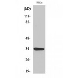MC2R / ACTHR / ACTH Receptor Antibody - Western blot of MC2-R antibody