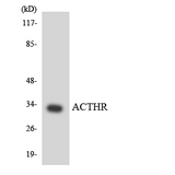 MC2R / ACTHR / ACTH Receptor Antibody - Western blot analysis of the lysates from COLO205 cells using ACTHR antibody.