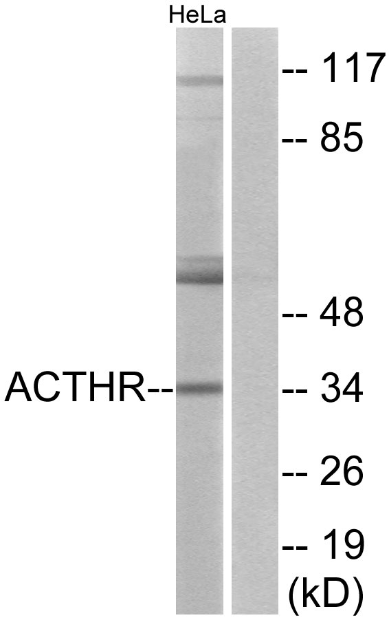 MC2R / ACTHR / ACTH Receptor Antibody - Western blot analysis of lysates from HeLa cells, using ACTHR Antibody. The lane on the right is blocked with the synthesized peptide.