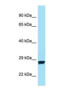 MC2R / ACTHR / ACTH Receptor Antibody - MC2R antibody Western blot of Fetal Kidney lysate. Antibody concentration 1 ug/ml.  This image was taken for the unconjugated form of this product. Other forms have not been tested.