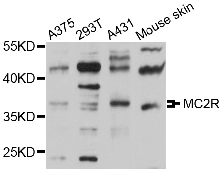 MC2R / ACTHR / ACTH Receptor Antibody - Western blot analysis of extracts of various cell lines.