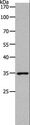 MC2R / ACTHR / ACTH Receptor Antibody - Western blot analysis of Human fetal kidney tissue, using MC2R Polyclonal Antibody at dilution of 1:1400.