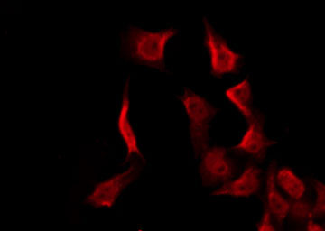 MC2R / ACTHR / ACTH Receptor Antibody - Staining HeLa cells by IF/ICC. The samples were fixed with PFA and permeabilized in 0.1% Triton X-100, then blocked in 10% serum for 45 min at 25°C. The primary antibody was diluted at 1:200 and incubated with the sample for 1 hour at 37°C. An Alexa Fluor 594 conjugated goat anti-rabbit IgG (H+L) Ab, diluted at 1/600, was used as the secondary antibody.