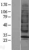 MC2R / ACTHR / ACTH Receptor Protein - Western validation with an anti-DDK antibody * L: Control HEK293 lysate R: Over-expression lysate