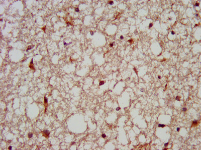 MC3R / MC3 Receptor Antibody - Immunohistochemistry image at a dilution of 1:200 and staining in paraffin-embedded human brain tissue performed on a Leica BondTM system. After dewaxing and hydration, antigen retrieval was mediated by high pressure in a citrate buffer (pH 6.0) . Section was blocked with 10% normal goat serum 30min at RT. Then primary antibody (1% BSA) was incubated at 4 °C overnight. The primary is detected by a biotinylated secondary antibody and visualized using an HRP conjugated SP system.