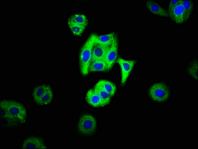 MC3R / MC3 Receptor Antibody - Immunofluorescence staining of HepG2 cells with MC3R Antibody at 1:66, counter-stained with DAPI. The cells were fixed in 4% formaldehyde, permeabilized using 0.2% Triton X-100 and blocked in 10% normal Goat Serum. The cells were then incubated with the antibody overnight at 4°C. The secondary antibody was Alexa Fluor 488-congugated AffiniPure Goat Anti-Rabbit IgG(H+L).