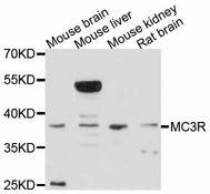 MC3R / MC3 Receptor Antibody - Western blot analysis of extracts of various cell lines, using MC3R antibody at 1:3000 dilution. The secondary antibody used was an HRP Goat Anti-Rabbit IgG (H+L) at 1:10000 dilution. Lysates were loaded 25ug per lane and 3% nonfat dry milk in TBST was used for blocking. An ECL Kit was used for detection and the exposure time was 30s.