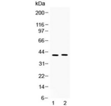 MC3R / MC3 Receptor Antibody - Western blot testing of 1) mouse kidney and 2) human COLO320 lysate with MC3 Receptor antibody at 0.5ug/ml. Predicted molecular weight ~40 kDa.