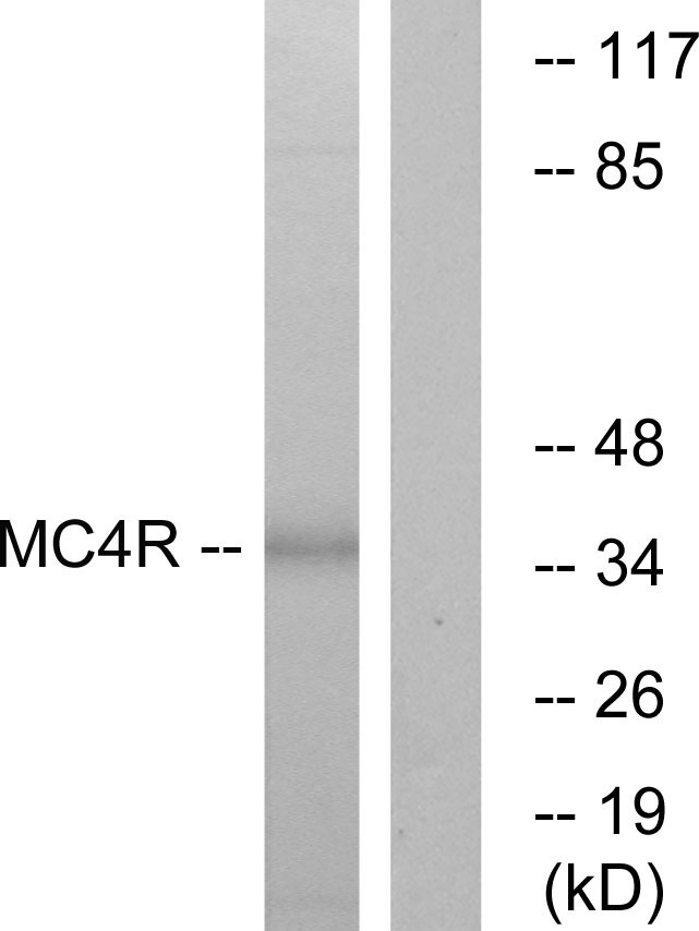 MC4R / Melanocortin 4 Receptor Antibody - Western blot analysis of lysates from MCF-7 cells, using MC4R Antibody. The lane on the right is blocked with the synthesized peptide.