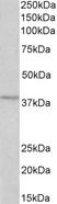 MC4R / Melanocortin 4 Receptor Antibody - MC4R antibody (2 ug/ml) staining of MCF7 lysate (35 ug protein in RIPA buffer). Primary incubation was 1 hour. Detected by chemiluminescence.