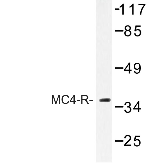 MC4R / Melanocortin 4 Receptor Antibody - Western blot of MC4-R (E315) pAb in extracts from MCF-7 cells.