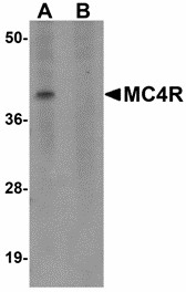 MC4R / Melanocortin 4 Receptor Antibody - Western blot of MC4R in rat brain tissue lysate with MC4R antibody at 1 ug/ml in (A) the absence and (B) the presence of blocking peptide. Below: Immunohistochemistry of MC4R in human brain tissue with MC4R antibody at 2.5 ug/ml.