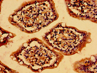 MC4R / Melanocortin 4 Receptor Antibody - Immunohistochemistry image of paraffin-embedded human small intestine tissue at a dilution of 1:100