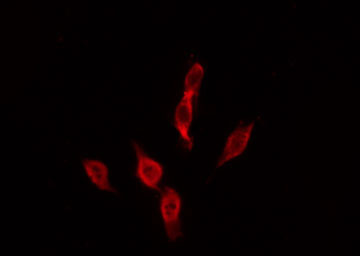 MC4R / Melanocortin 4 Receptor Antibody - Staining MCF-7 cells by IF/ICC. The samples were fixed with PFA and permeabilized in 0.1% Triton X-100, then blocked in 10% serum for 45 min at 25°C. The primary antibody was diluted at 1:200 and incubated with the sample for 1 hour at 37°C. An Alexa Fluor 594 conjugated goat anti-rabbit IgG (H+L) Ab, diluted at 1/600, was used as the secondary antibody.