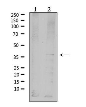 MC4R / Melanocortin 4 Receptor Antibody - Western blot analysis of extracts of HepG2 cells using MC4R antibody. Lane 1 was treated with the antigen-specific peptide.