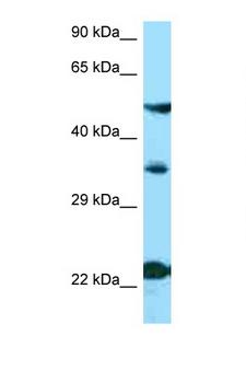 MC4R / Melanocortin 4 Receptor Antibody - MC4R antibody Western blot of ACHN Cell lysate. Antibody concentration 1 ug/ml.  This image was taken for the unconjugated form of this product. Other forms have not been tested.
