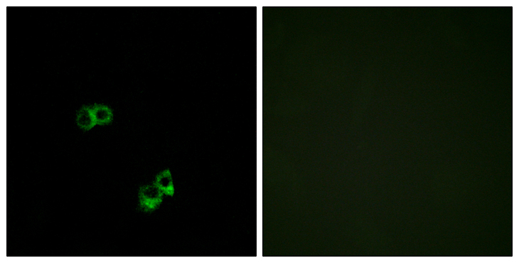 MC5R / MC5 Receptor Antibody - Immunofluorescence analysis of MCF7 cells, using MC5R Antibody. The picture on the right is blocked with the synthesized peptide.