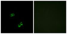 MC5R / MC5 Receptor Antibody - Immunofluorescence analysis of MCF7 cells, using MC5R Antibody. The picture on the right is blocked with the synthesized peptide.