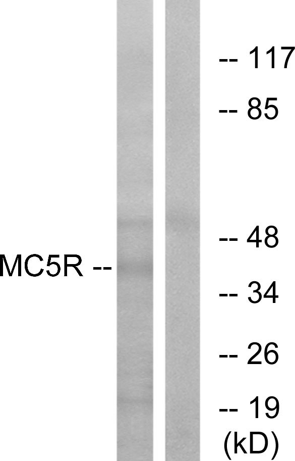 MC5R / MC5 Receptor Antibody - Western blot analysis of lysates from K562 cells, using MC5R Antibody. The lane on the right is blocked with the synthesized peptide.