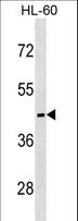 MC5R / MC5 Receptor Antibody - MC5R Antibody western blot of HL-60 cell line lysates (35 ug/lane). The MC5R antibody detected the MC5R protein (arrow).
