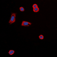 MC5R / MC5 Receptor Antibody - Immunofluorescent analysis of MC5 Receptor staining in MCF7 cells. Formalin-fixed cells were permeabilized with 0.1% Triton X-100 in TBS for 5-10 minutes and blocked with 3% BSA-PBS for 30 minutes at room temperature. Cells were probed with the primary antibody in 3% BSA-PBS and incubated overnight at 4 deg C in a humidified chamber. Cells were washed with PBST and incubated with a DyLight 594-conjugated secondary antibody (red) in PBS at room temperature in the dark. DAPI was used to stain the cell nuclei (blue).