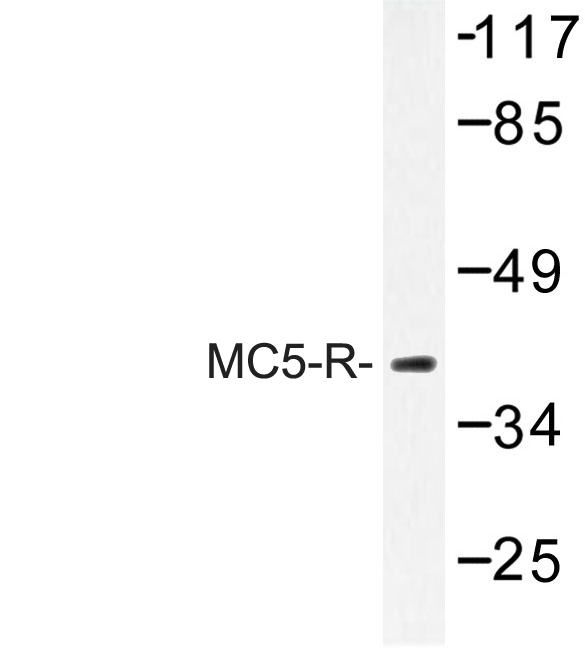 MC5R / MC5 Receptor Antibody - Western blot of MC5-R (E308) pAb in extracts from K562 cells.