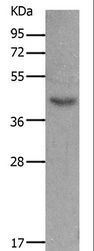MC5R / MC5 Receptor Antibody - Western blot analysis of Mouse muscle tissue, using MC5R Polyclonal Antibody at dilution of 1:1200.