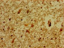 MC5R / MC5 Receptor Antibody - Immunohistochemistry image of paraffin-embedded human brain tissue at a dilution of 1:100