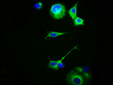MC5R / MC5 Receptor Antibody - Immunofluorescence staining of MCF-7 cells with MC5R Antibody at 1:100, counter-stained with DAPI. The cells were fixed in 4% formaldehyde, permeabilized using 0.2% Triton X-100 and blocked in 10% normal Goat Serum. The cells were then incubated with the antibody overnight at 4°C. The secondary antibody was Alexa Fluor 488-congugated AffiniPure Goat Anti-Rabbit IgG(H+L).