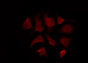 MC5R / MC5 Receptor Antibody - Staining HeLa cells by IF/ICC. The samples were fixed with PFA and permeabilized in 0.1% Triton X-100, then blocked in 10% serum for 45 min at 25°C. The primary antibody was diluted at 1:200 and incubated with the sample for 1 hour at 37°C. An Alexa Fluor 594 conjugated goat anti-rabbit IgG (H+L) Ab, diluted at 1/600, was used as the secondary antibody.