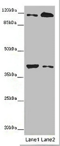MCA32 Antibody - Western blot All Lanes: MILR1 antibody at 14 ug/ml Lane 1: Mouse brain tissue Lane 2: HepG-2 whole cell lysate Secondary Goat polyclonal to rabbit IgG at 1/10000 dilution Predicted band size: 39,28,29 kDa Observed band size: 39,120 kDa