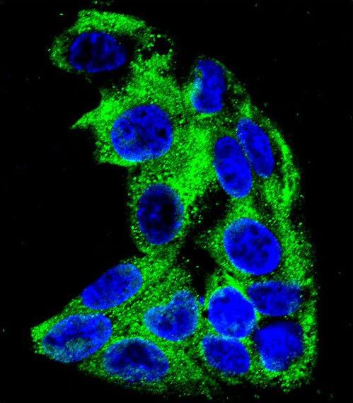 MCAD / ACADM Antibody - Confocal immunofluorescence of ACADM Antibody with HepG2 cell followed by Alexa Fluor 488-conjugated goat anti-rabbit lgG (green). DAPI was used to stain the cell nuclear (blue).