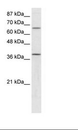 MCAD / ACADM Antibody - HepG2 Cell Lysate.  This image was taken for the unconjugated form of this product. Other forms have not been tested.