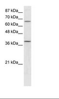 MCAD / ACADM Antibody - HepG2 Cell Lysate.  This image was taken for the unconjugated form of this product. Other forms have not been tested.